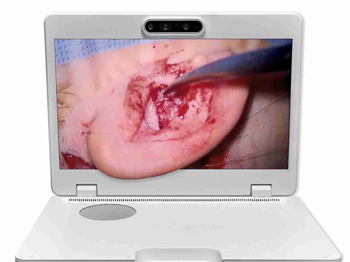 达擎之＂Heads-up 3D显微手术显示系统＂，，整合4K裸眼3D显示及眼球追踪系统，，，具备快速追踪人眼移动位置功能，，减轻医师长时间维持固定姿势的负担，，，，让医师能有更宽广清晰的3D立体视野及更舒适的姿势来执行手术。。。